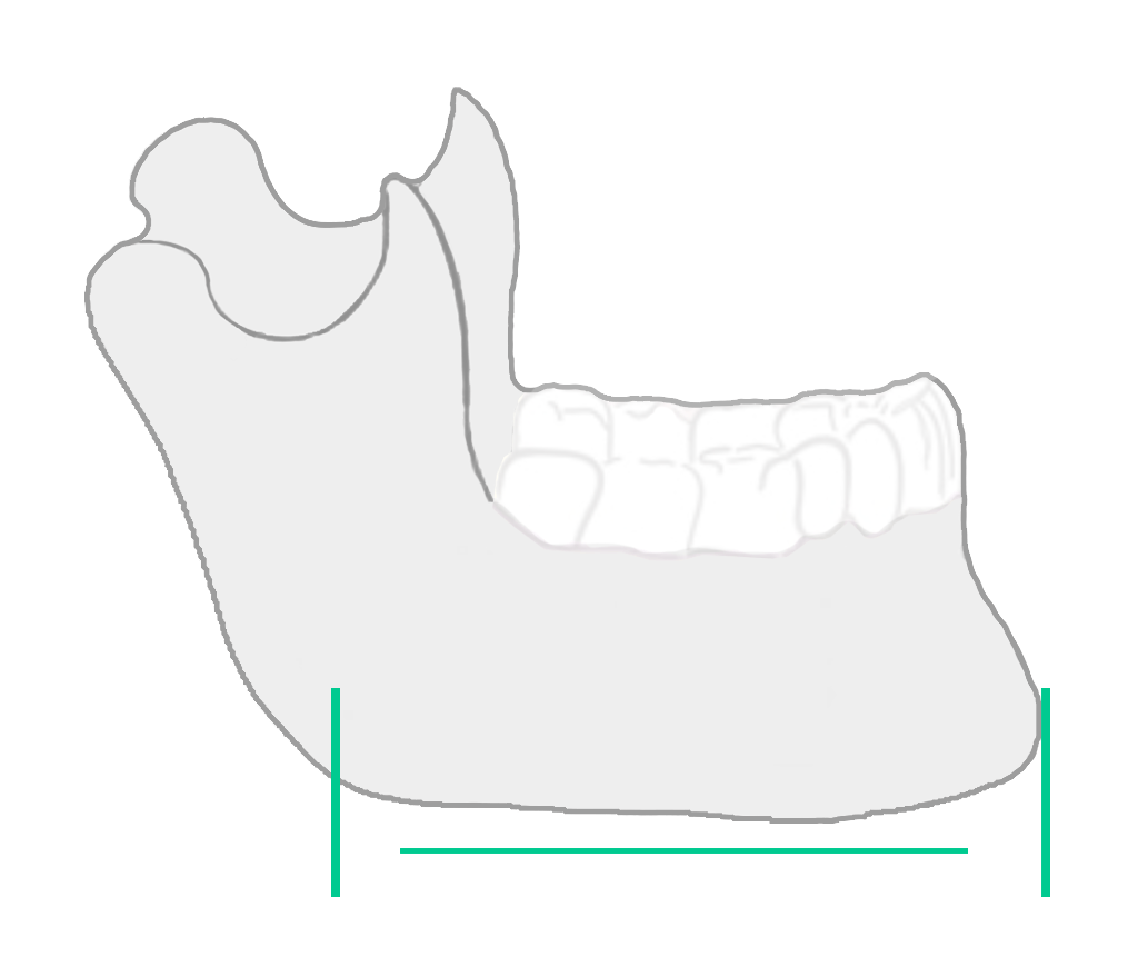 Denho u-neck / mandíbula.